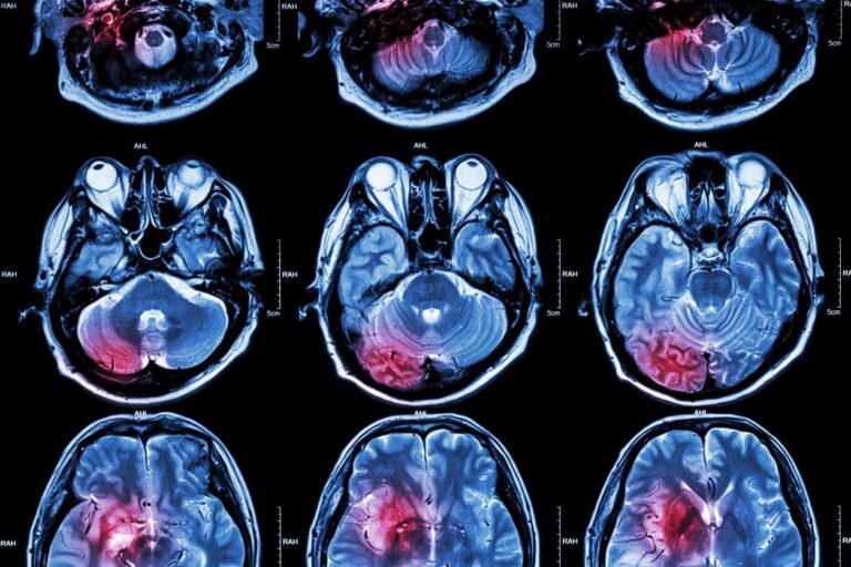 ADHD Brain Toolkit: Regulation, Focus & Flow